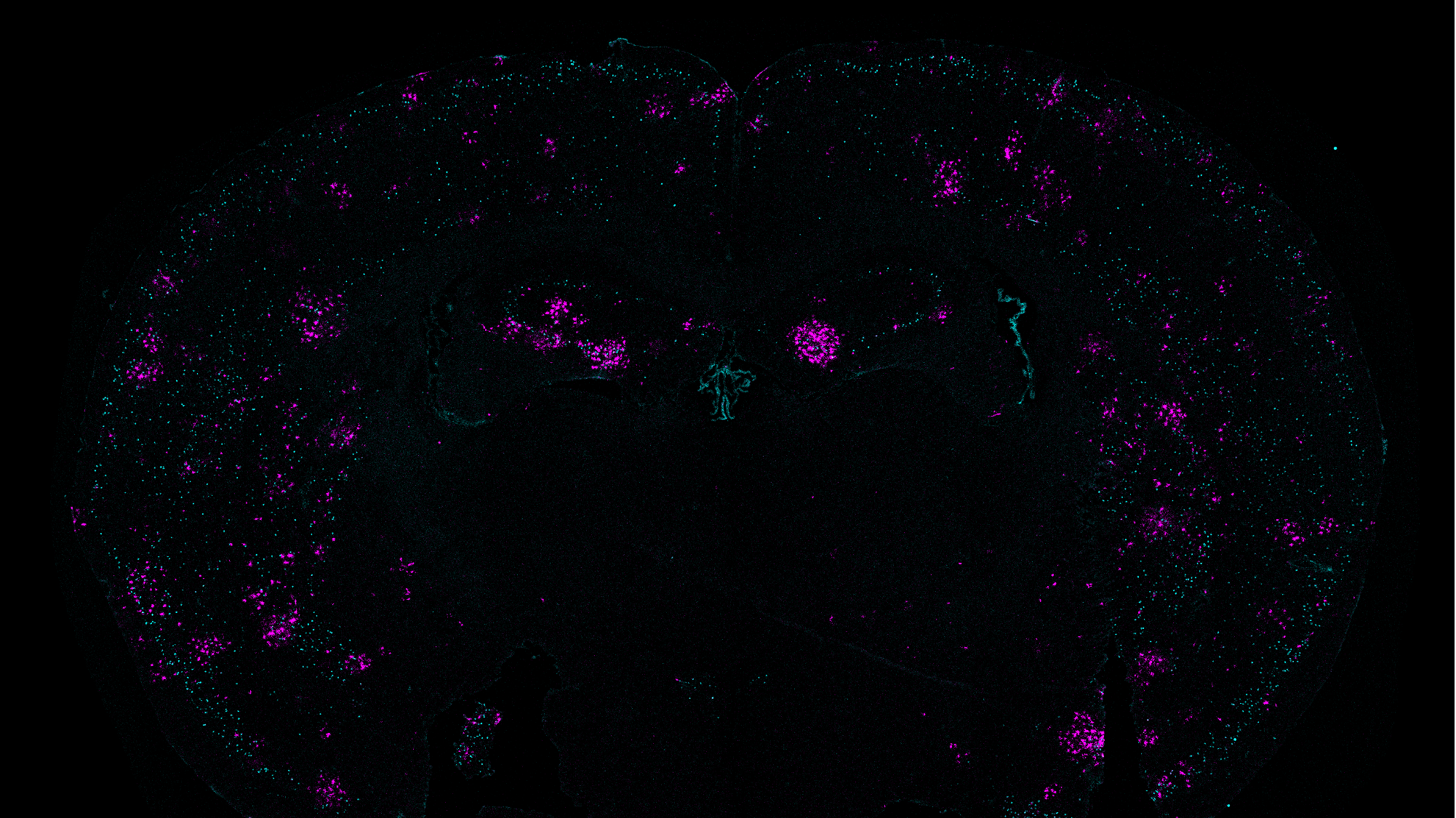 On a black background in the curvy M-like shape of a mouse brain cross section, many patches of tiny teal and purple dots appear