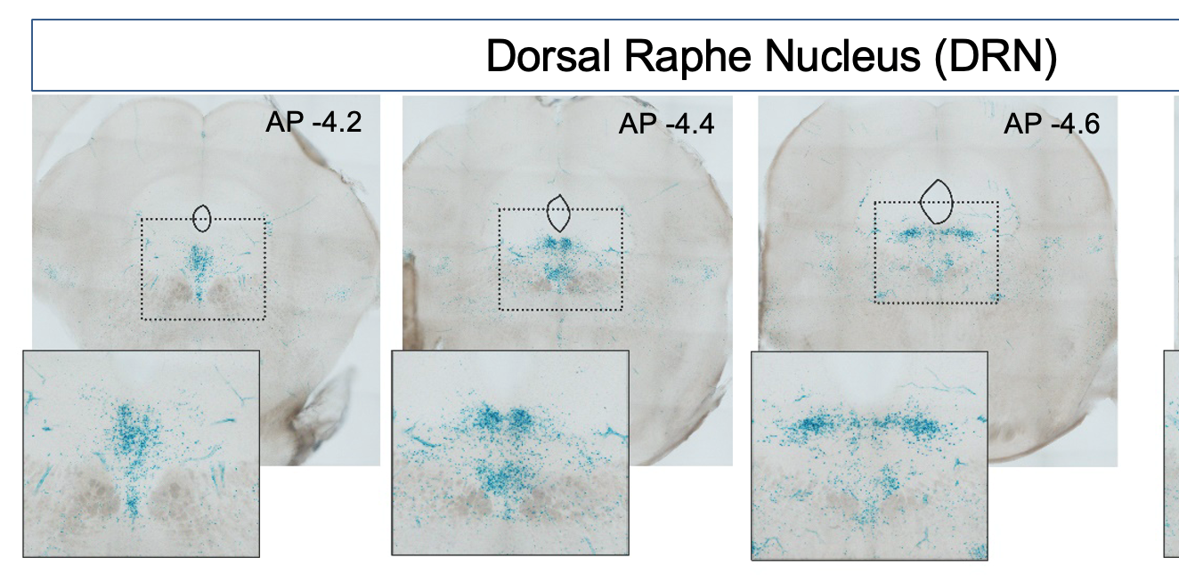 Three panels show off-white brain tissue sections. Clusters of dark blue spots in the center indicate cells expressing the IL-1R1 receptor.