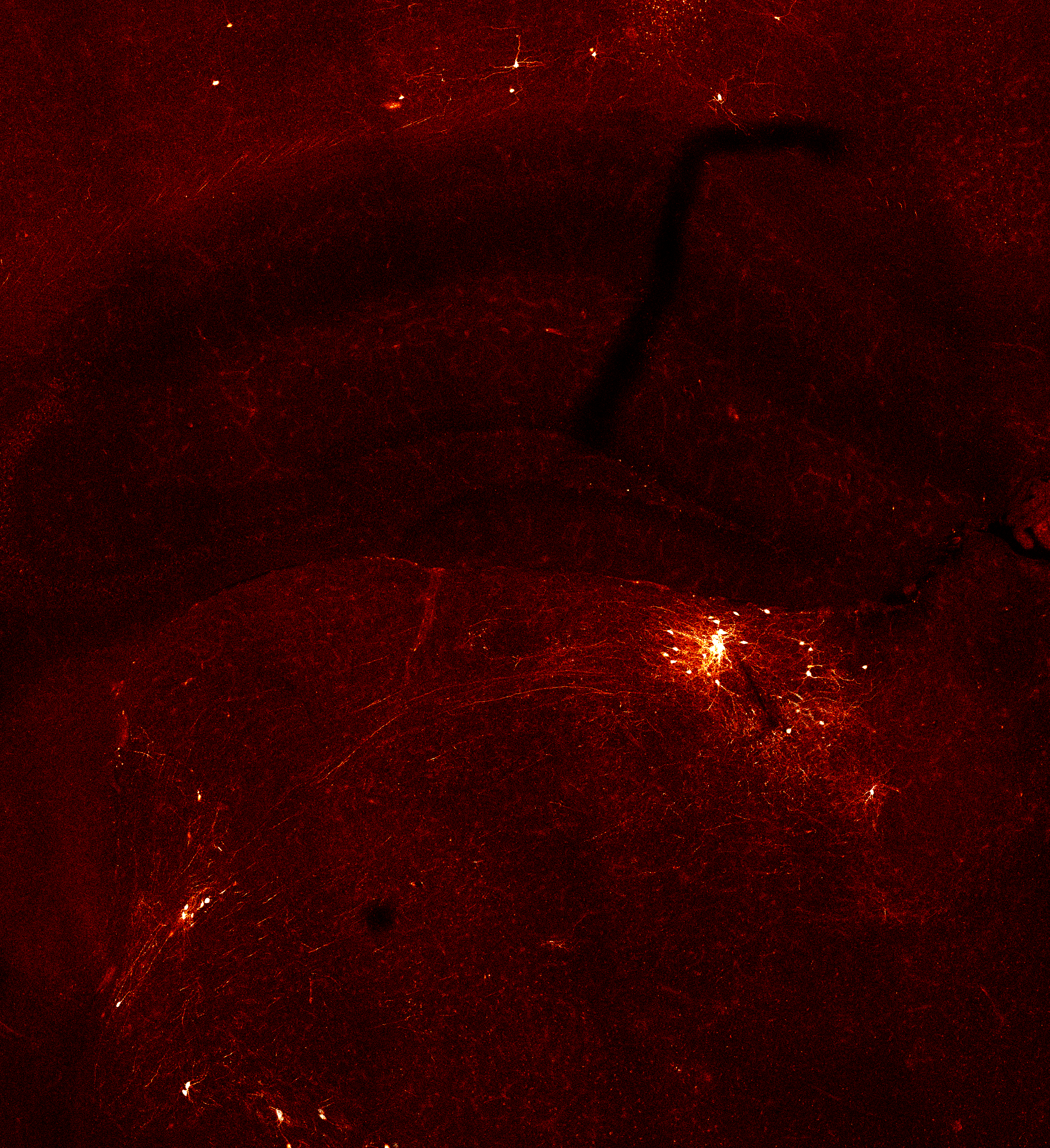 Isloated clusters of neurons glow orange-yellow amid a dark background