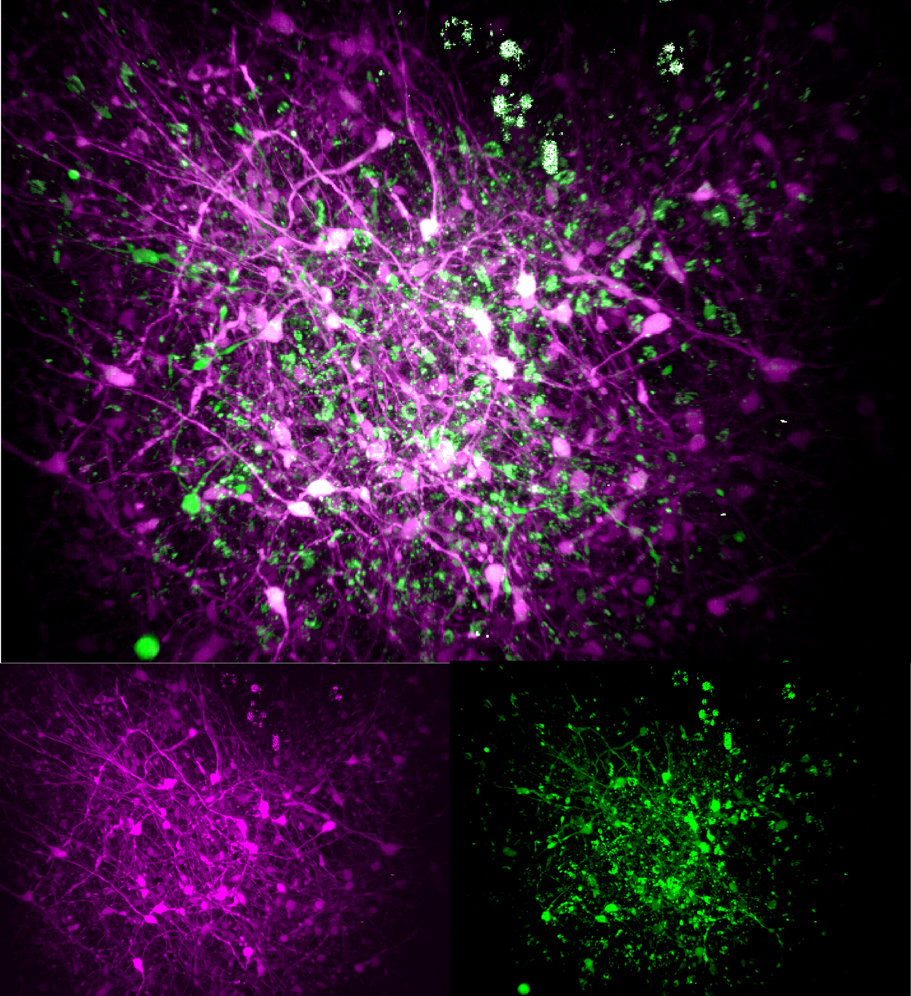 Three views of an organoid cell culture show the constiuent cells of the vaguely round, tangled mass of cells.  In the different views the cells are highlighted in different colors such as magenta and green.