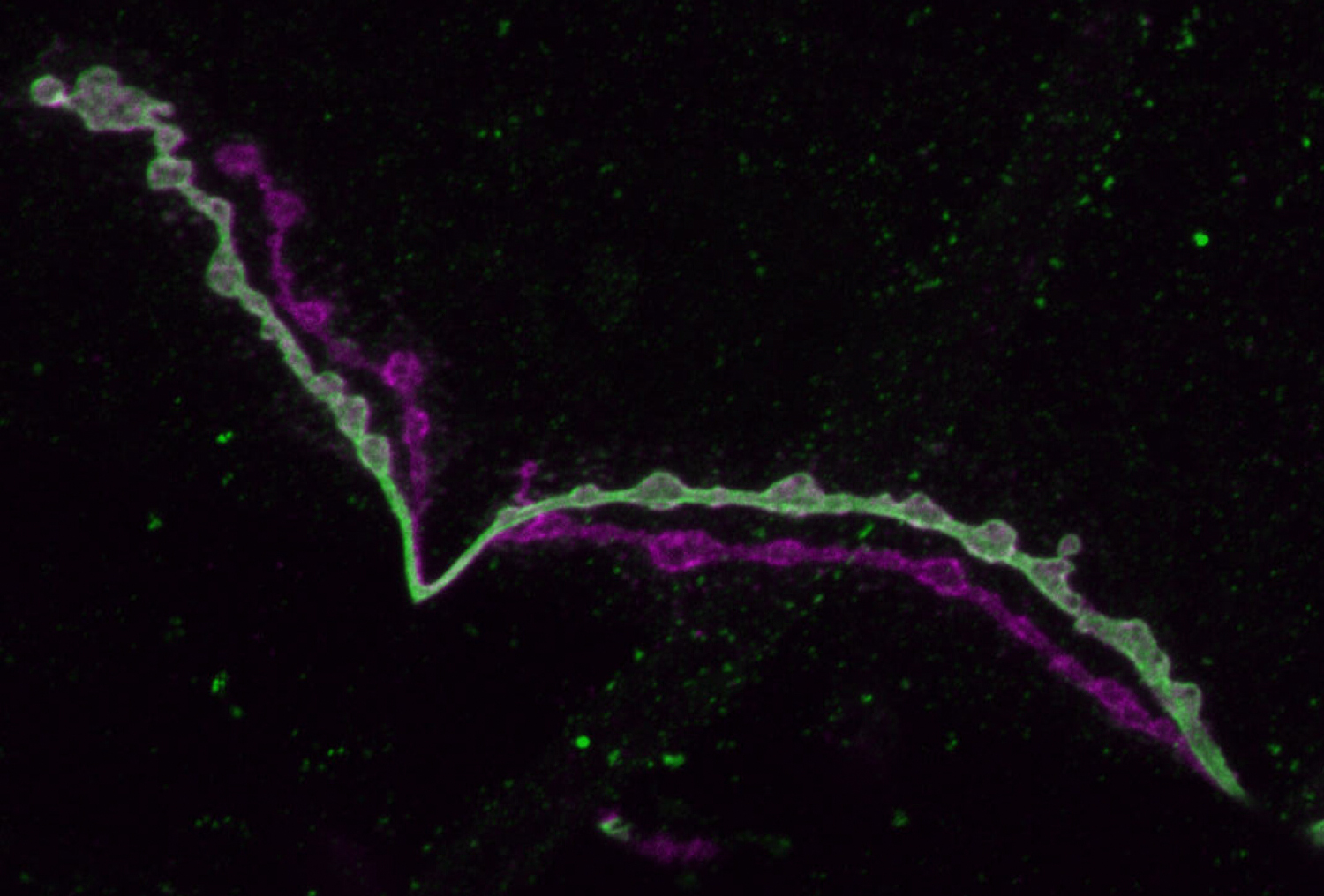 Over a black background two neural axons extend through the frame like lumpy check marks. One is light green with noticable darker green splotches within its lumps. The other is magenta and has no dark green splotches.