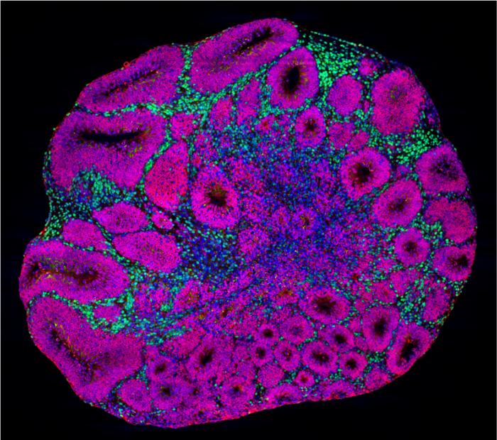 A nearly circular shape has many smaller magenta circles within that have black centers. In the middle there are blue patches and along top and left edges there are yellow-green speckles.