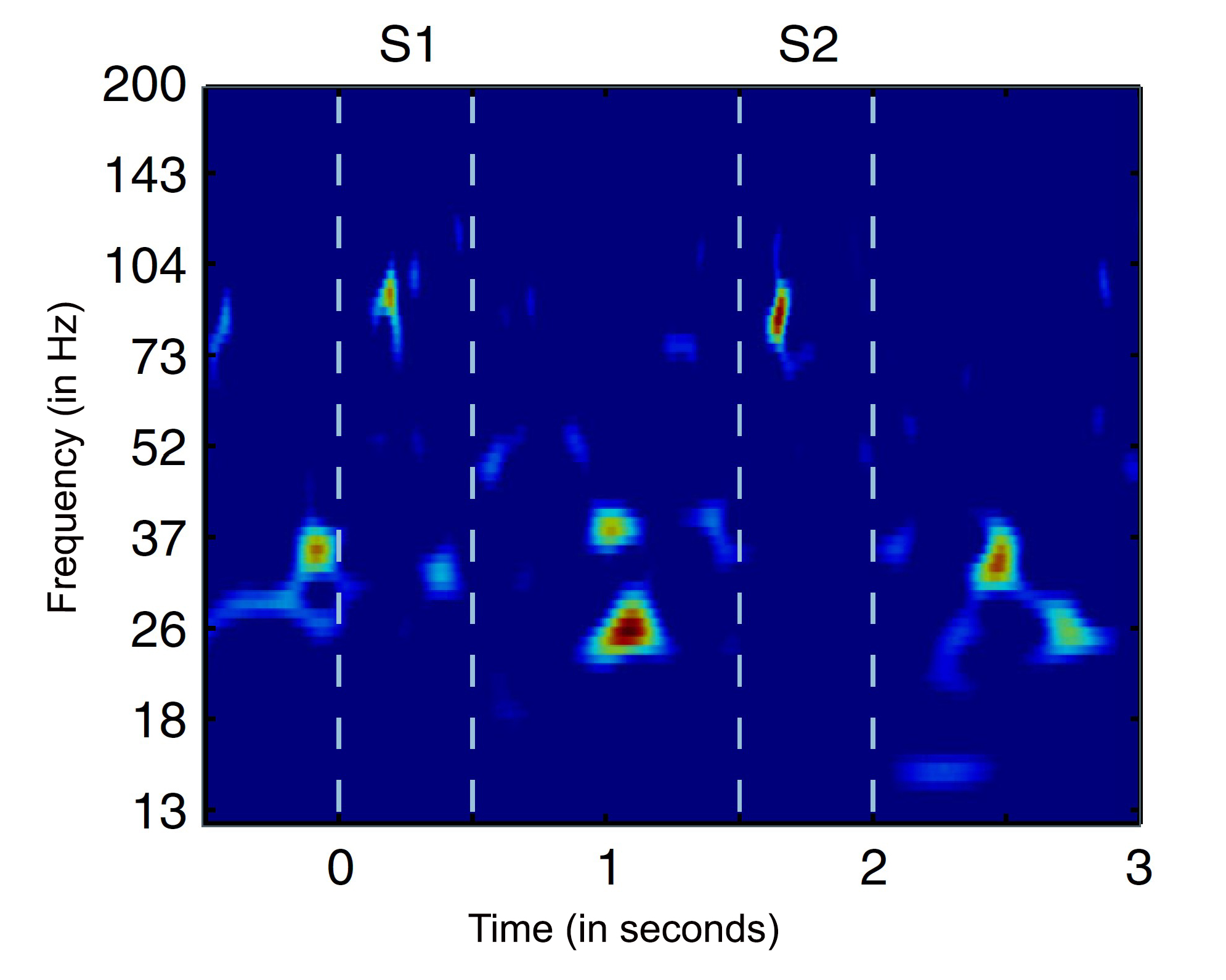 A chart from a study plots bursts of brain waves of varying frequency at specific times. The bursts are represented as warm colors against a the blue background. When there are low frequency bursts there aren't high frequency bursts and vice versa. 
