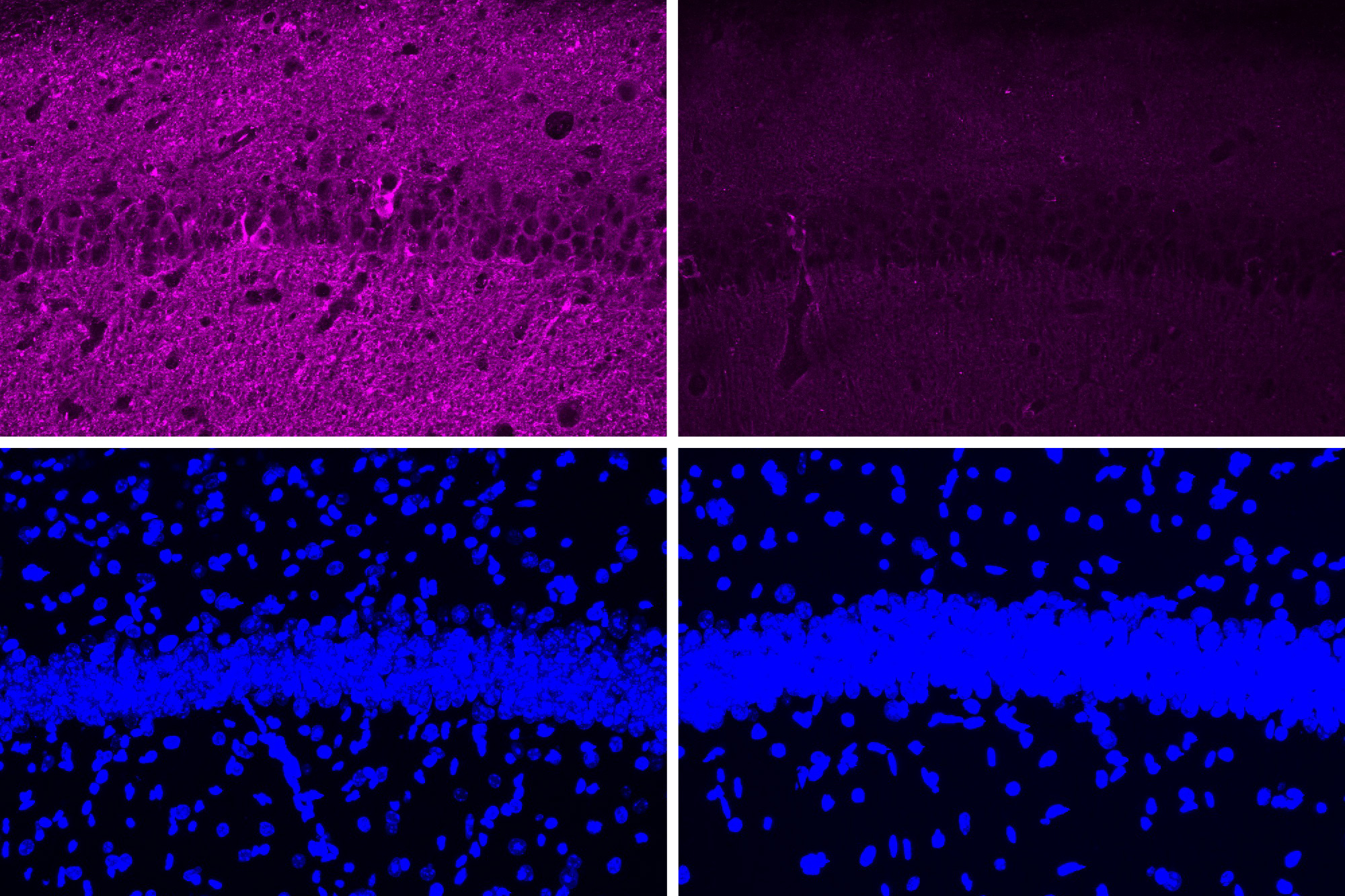 Four panels in a 2x2 array. The top left shows a lot of purple staining of cells. The top right shows much less purple. The bottom row shows two nearly idential stripes of blue with lots of blue spots above and below.