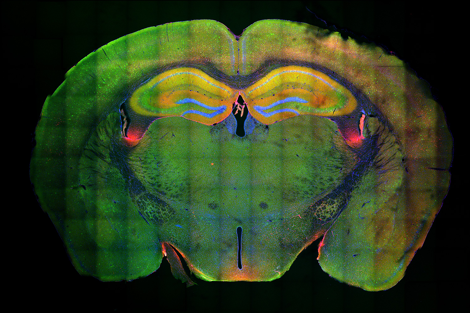 A colorful cross section of a mouse brain
