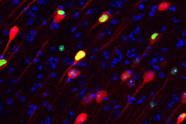 Neurons stained green and red appear over a black background