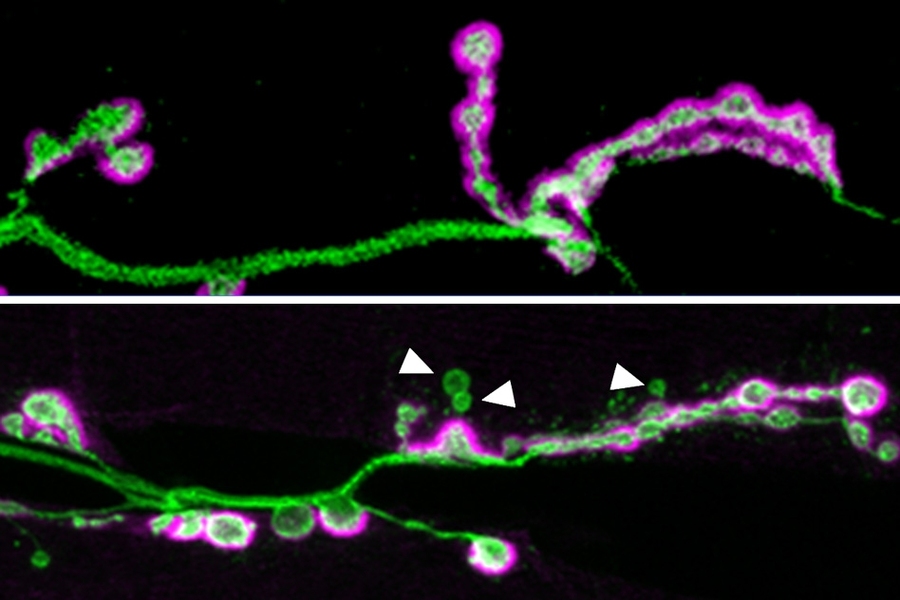 Two panels show neural axons. On the top the green axon shows bright white and purple bulbs but on the bottom in places indicated with white arrows there is less such growth apparent