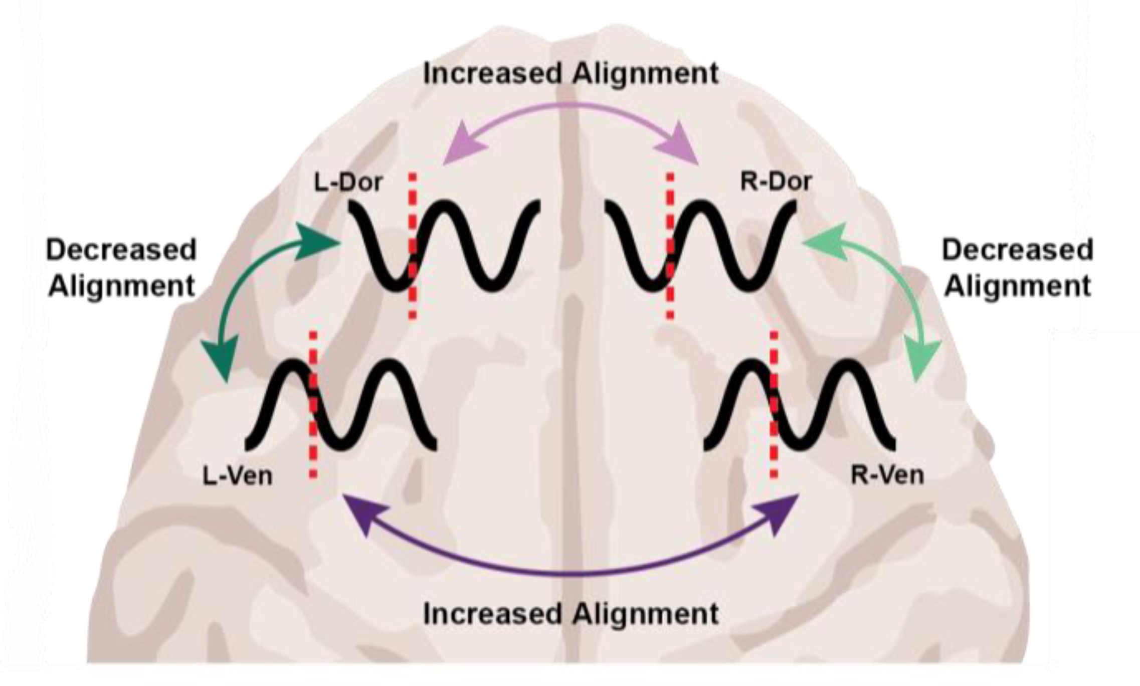 A cartoon of a brain is superposed with waves to show that within hemispheres they are out of phase but across hemispheres they are in phase.