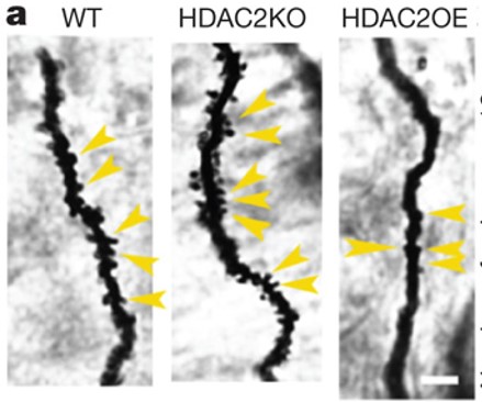 Three vertical panels show bumpy neural branches. The degree of bumps differs from panel to paneland bumps are denoted by yellow arrows.
