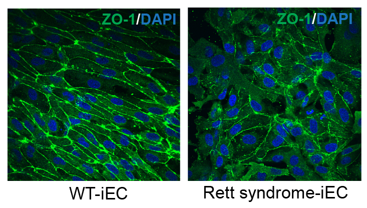 Two panels show blue cells surrounded by thin green outlines. The outlines are much more consistent and prevalent in the image on the left, which is labeled as the wild type, than on the right which is labeled Rett syndrome.