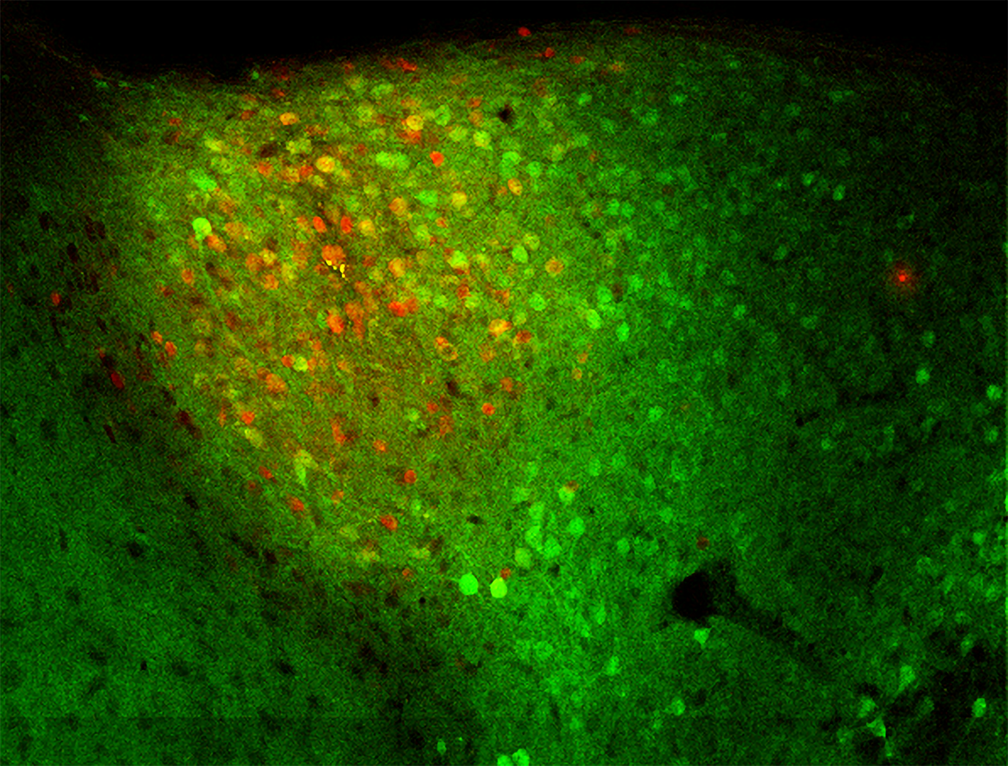 An area of brain tissue mostly glows green but has a red patch in the middle