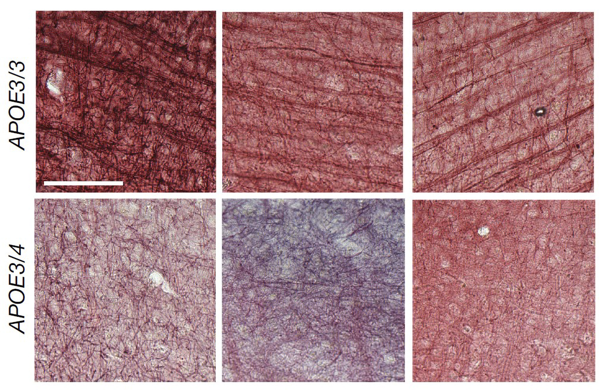 A 3 by 2 array of panels shows a top row of brain tissue squares in which black streaks are very clear. In the bottom row the streaks are less clear.