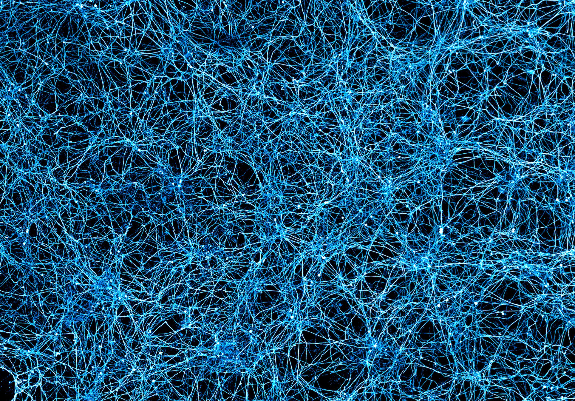 A dense tangle of light blue neurons over a black background