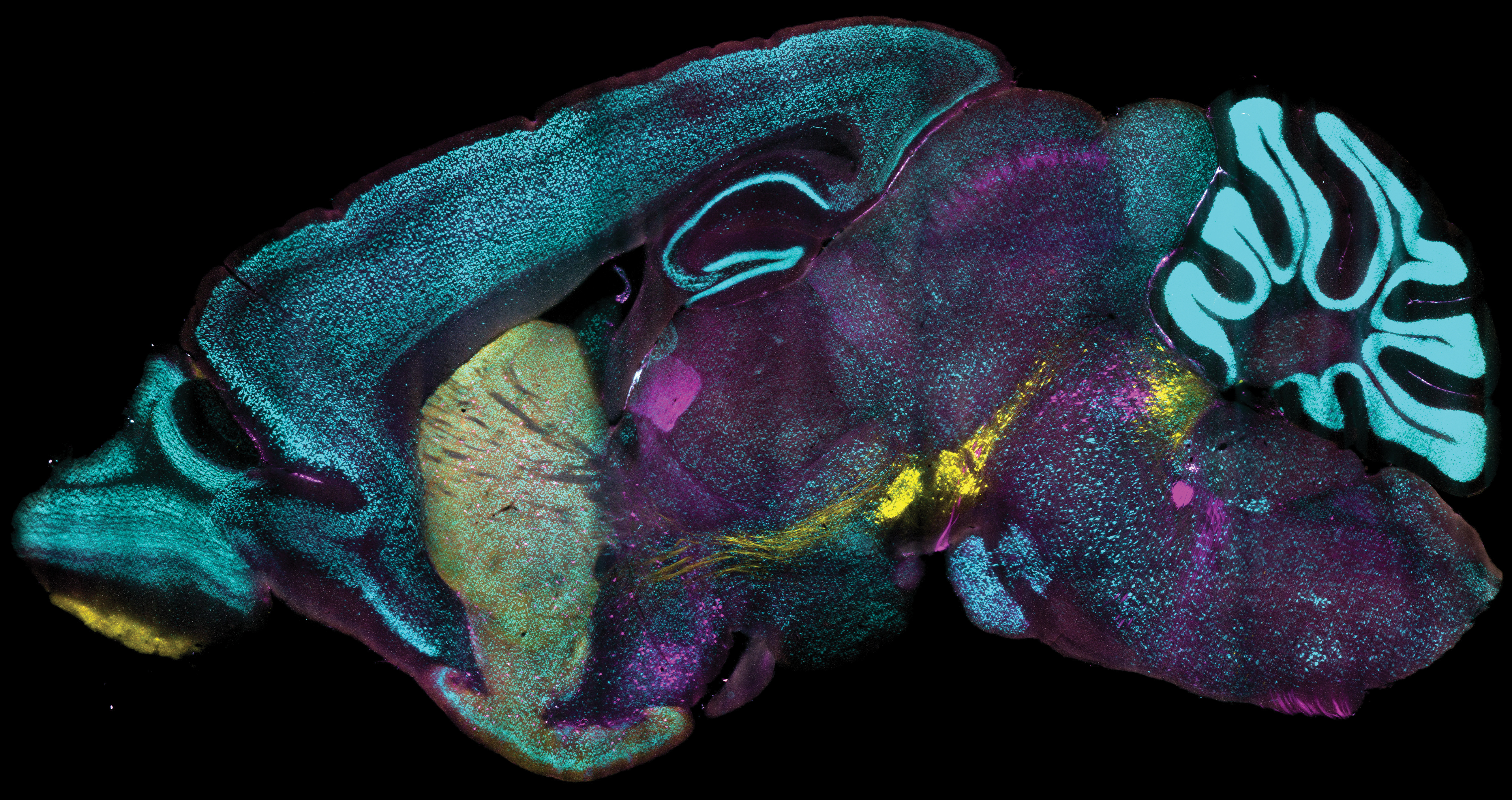 A saggital cross section of a mouse brain is richly stained in three distinct colors in three distinct areas: yellow in the very front and about halfway toward the back; green in a large area toward the front and cyan across wide areas, especially the cerebellum in the back