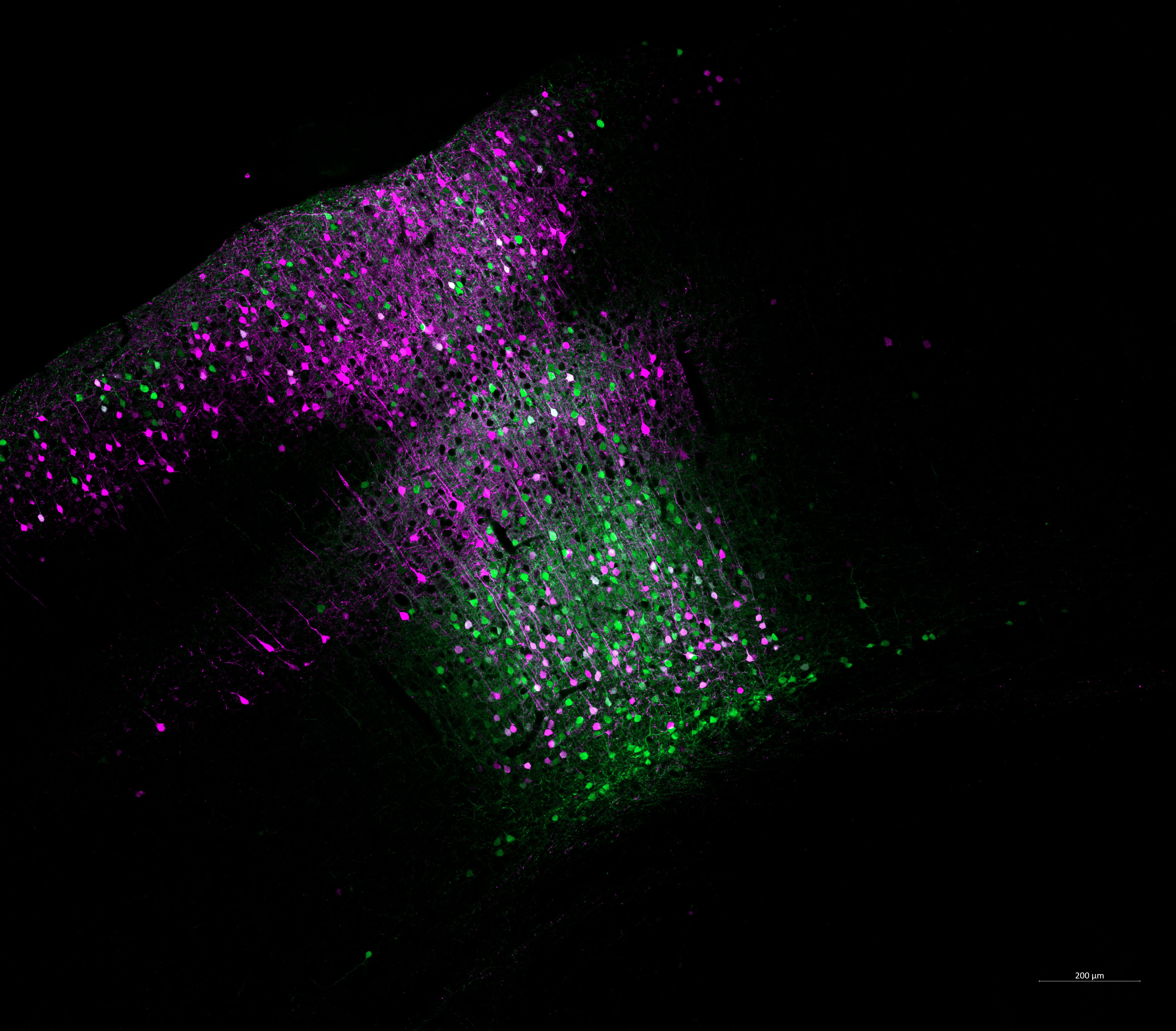 Hundreds of neurons stained either green or magenta (or both) are visible in a diagonal swath through the cortex of a mouse brain. The image background is black.