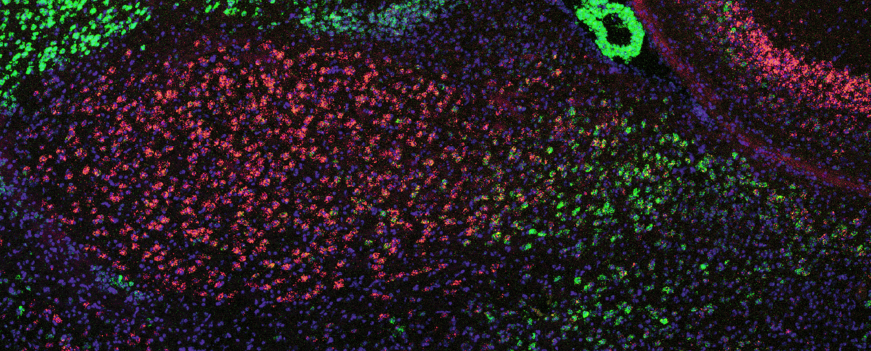 The almond shape of the amygdala is composed of cells stained red (on the left) and green (on the right).