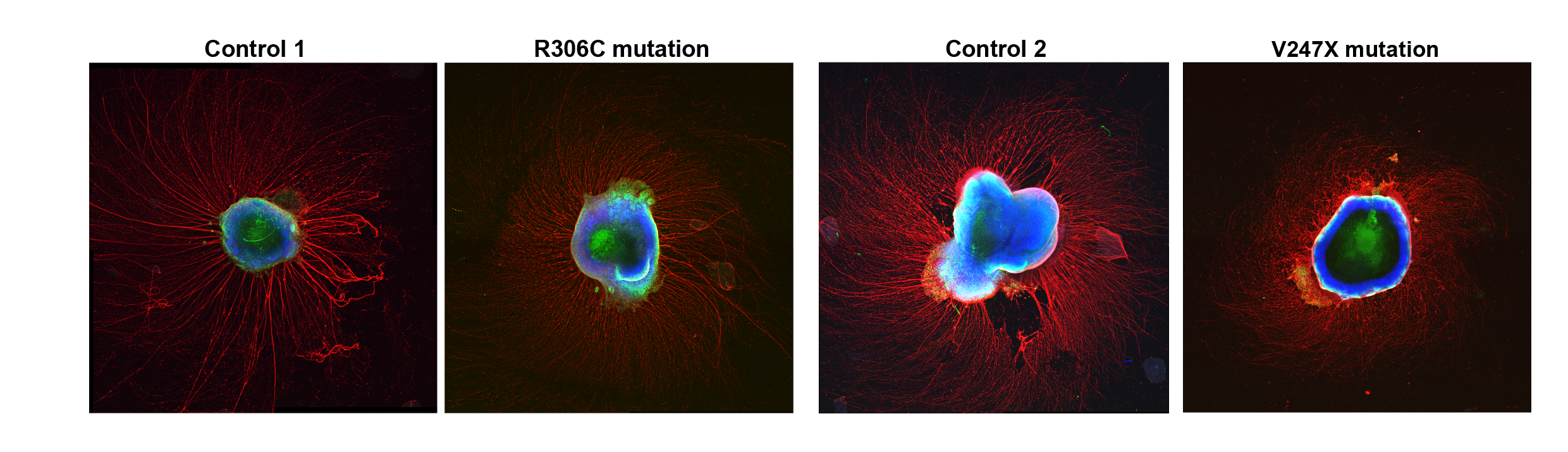 Four images of roundish cerebral organoids are shown in a horizontal row. The insides are stained blue, and each has long extensions radiating outward in red. The first and third are labeled "control 1" and "control 2". The organoids to the right of each control are labeled with the name of a specific mutation ("R306C" and "V247X")