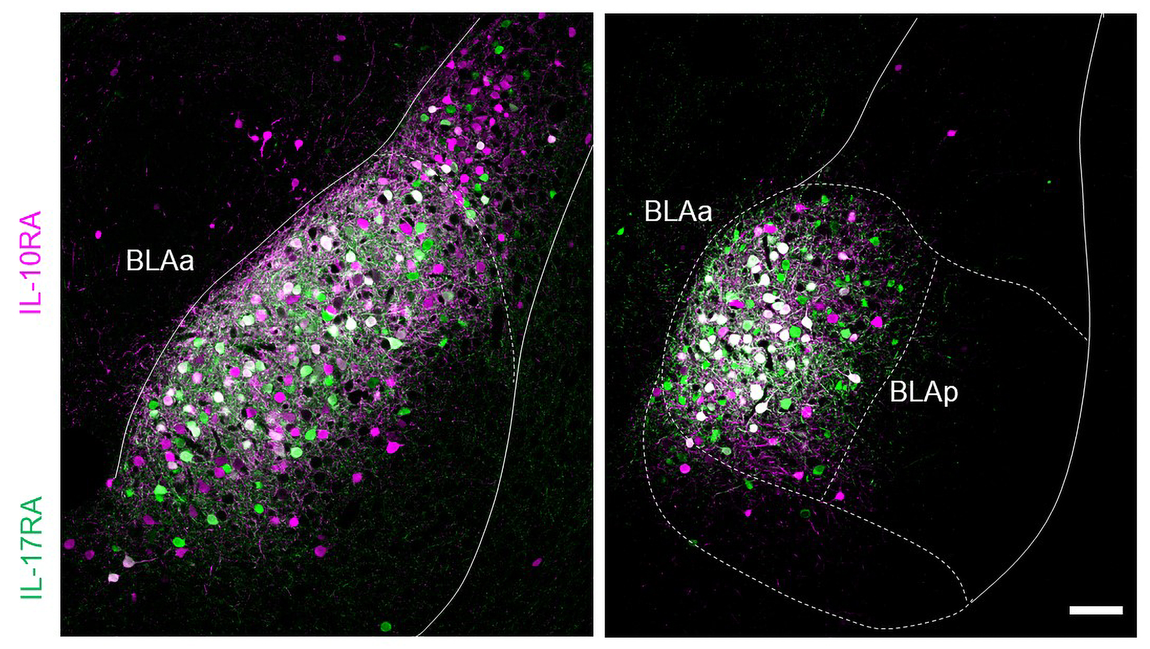 A view of the basolateral amygdala is composed of intermingled cells stained magenta or green