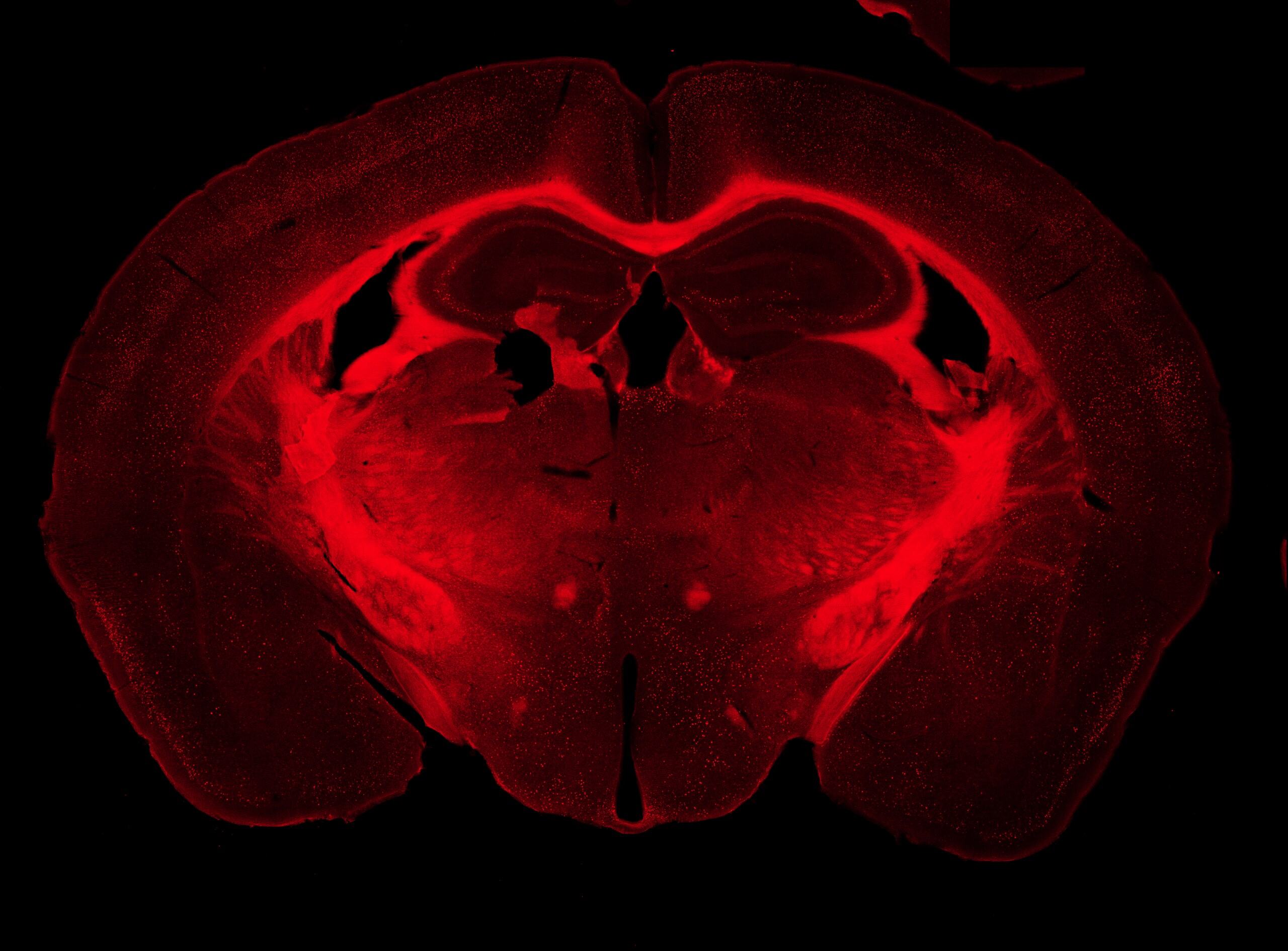 A red-stained coronal cross-section of a mouse brain