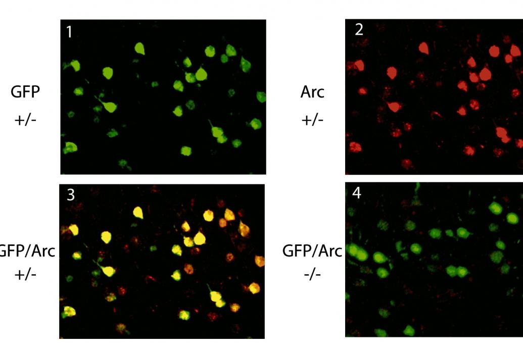 In four panels we see neurons on a black background stained in red, green or yellow colors.
