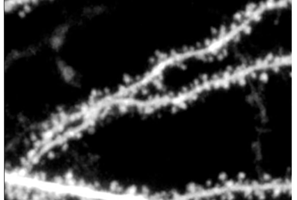 A black and white image shows sections of neural dendrites which appear as long thin lines with many small bumps along them.