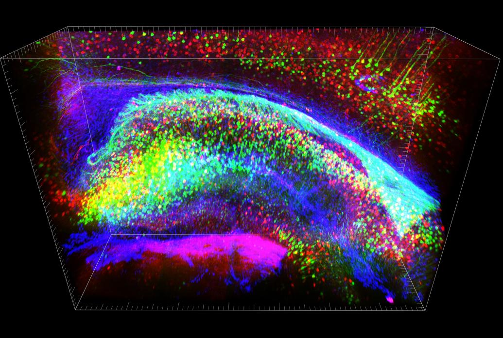 A clarified brain with many different types of cells stained different colors
