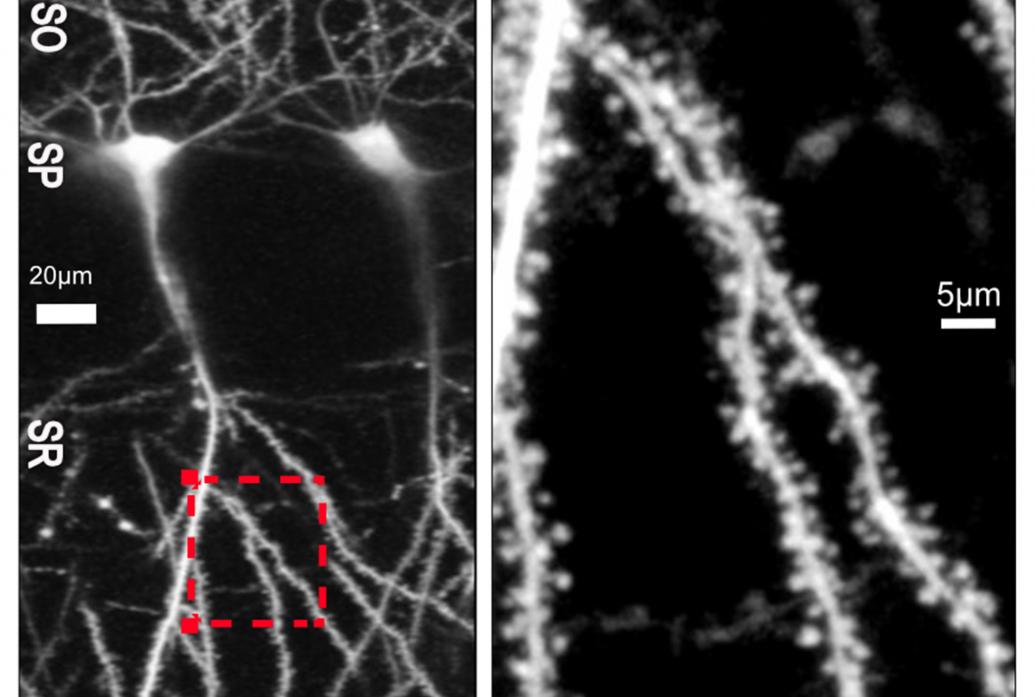 Two black and white panels show a neuron on the left and a spiny zoomed-in section of its dendrites on the right