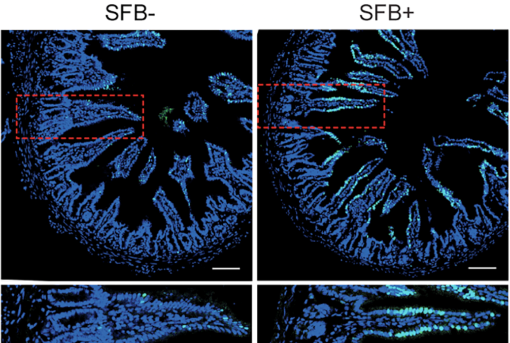 Four panels in a 2x2 array show a segment of intestine cross-sectioned in a deep blue. The left side shows when there is no bacteria and no cytokine response. On the right side there is bacteria and some of the tissue glows white. The bottom row of panels shows those areas zoomed in.