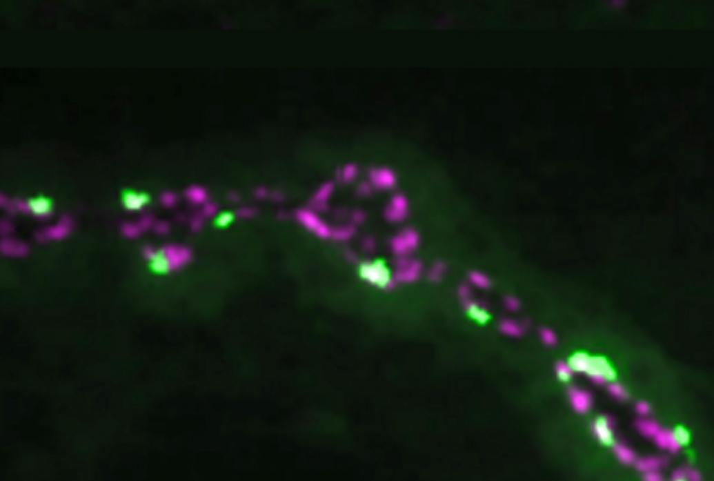 Bright green and bright blue dots line two lengths of a fly neuromuscular junction