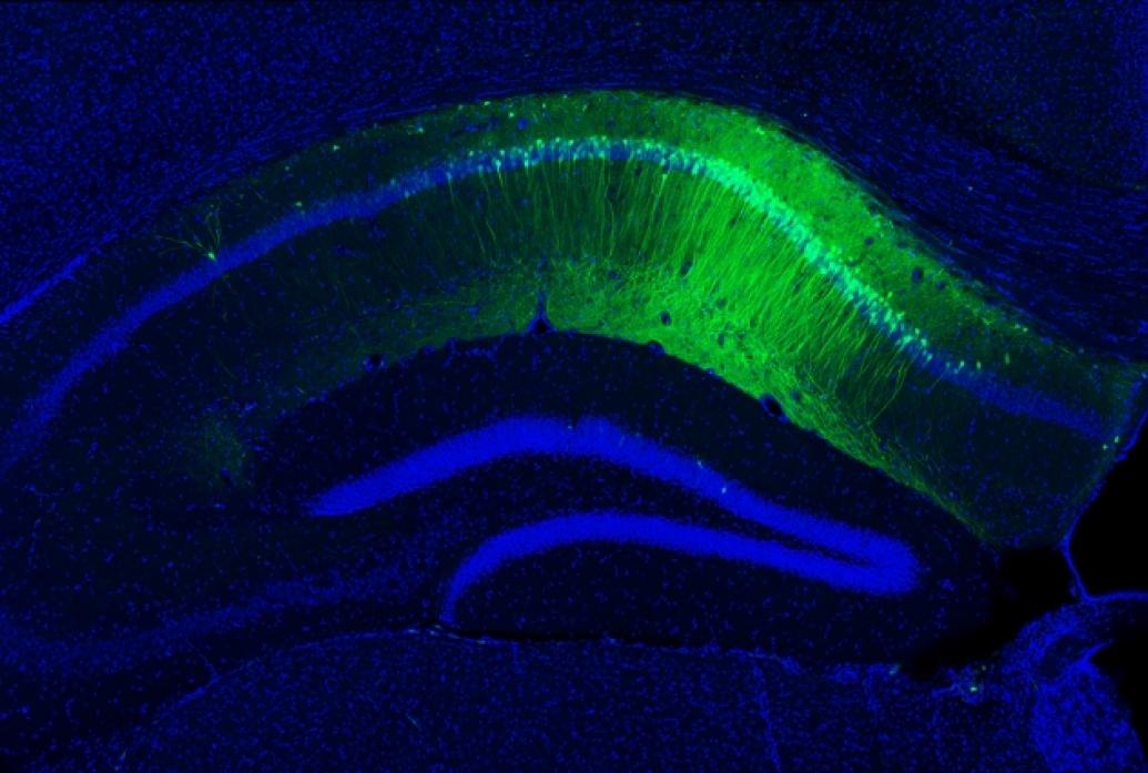 A hippocampal slice with green neurons representing a memory engram