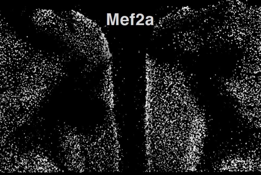 A black and white slide shows white specks indicating the protein Mef2a all over both hemispheres of the frontal cortex except where the gene was knocked out. Those areas are empty of specks..