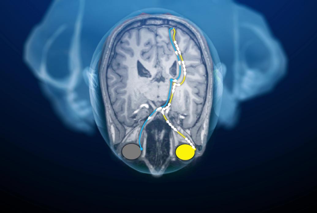 A cartoon of a man seen from overhead shows his brain with two eyes, yellow or green, sending flashes of input to the back of the brain