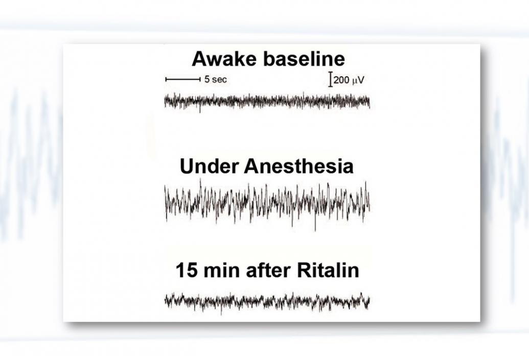A slide shows EEG waves of a rat while awake, anesthetized and then reanimated with Ritalin