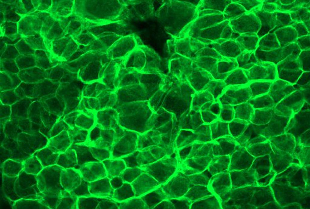 Bright green glow outlines hundreds of cells in a microscope image of tissue