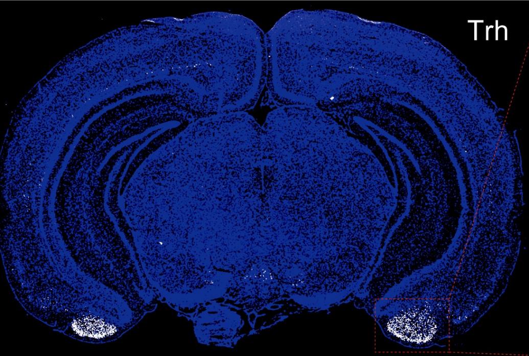 Microscope images show a blue-stained mouse brain. At the bottom on each side are cells shining white. A second panel shows higher magnification of that area