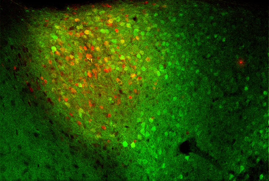 An area of brain tissue mostly glows green but has a red patch in the middle