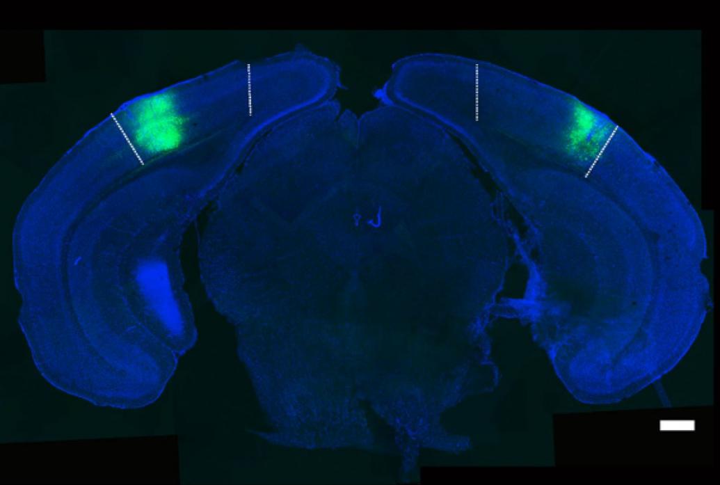 A blue coronal mouse brain section shows green highlighting in the visual cortex