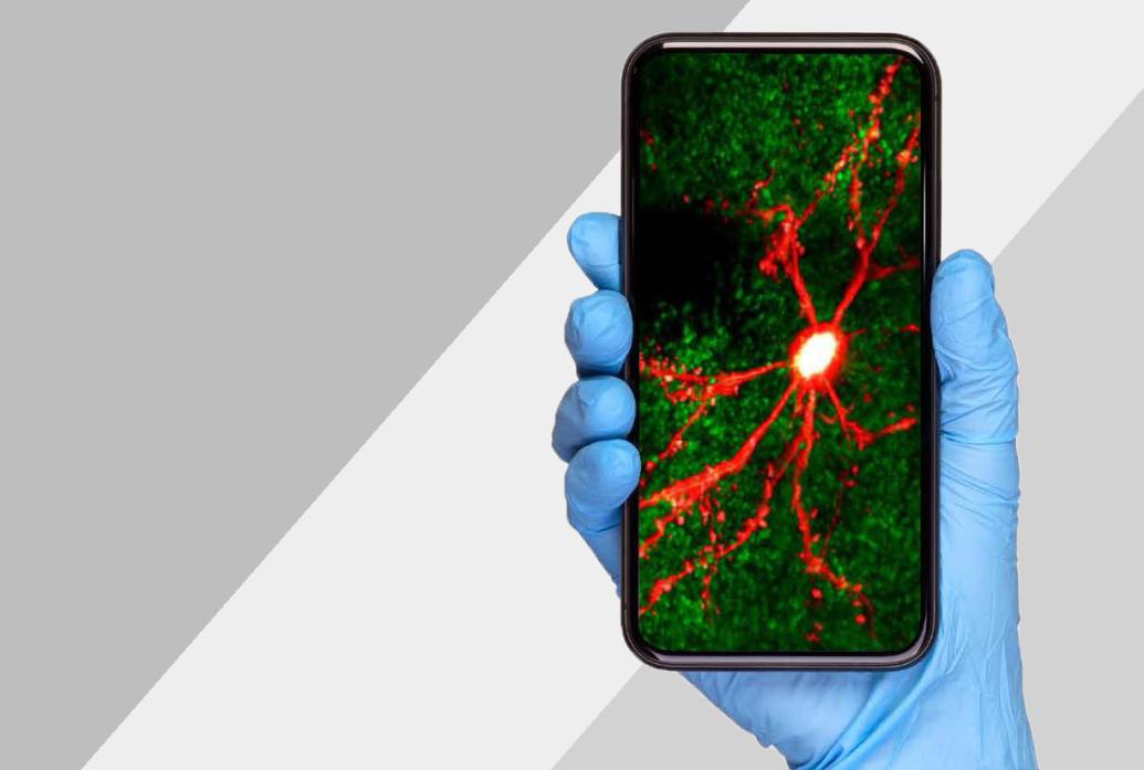 A hand wearing a blue latex glove holds up a cell phone showing the image of a red-stained neuron