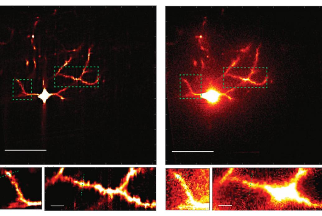 Four panels show a neuron glowing in red and yellow. The top left panel shows a neurn looing pretty sharp. Below that are zoomed in sections also looking detailed. On the right is a neuron that looks hazy. Below that are zoomed in sections that are also clouded.