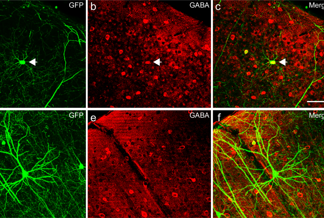 Six panels show neurons stained in green or red colors to inidicae the presence of GABA, an inhibitory neurotransmitter