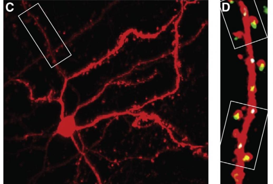 In a square left panel we see a red neuron with sprawling red branches. In a vertical right panel we zoom in on a branch and see little yellow and white spots along its length