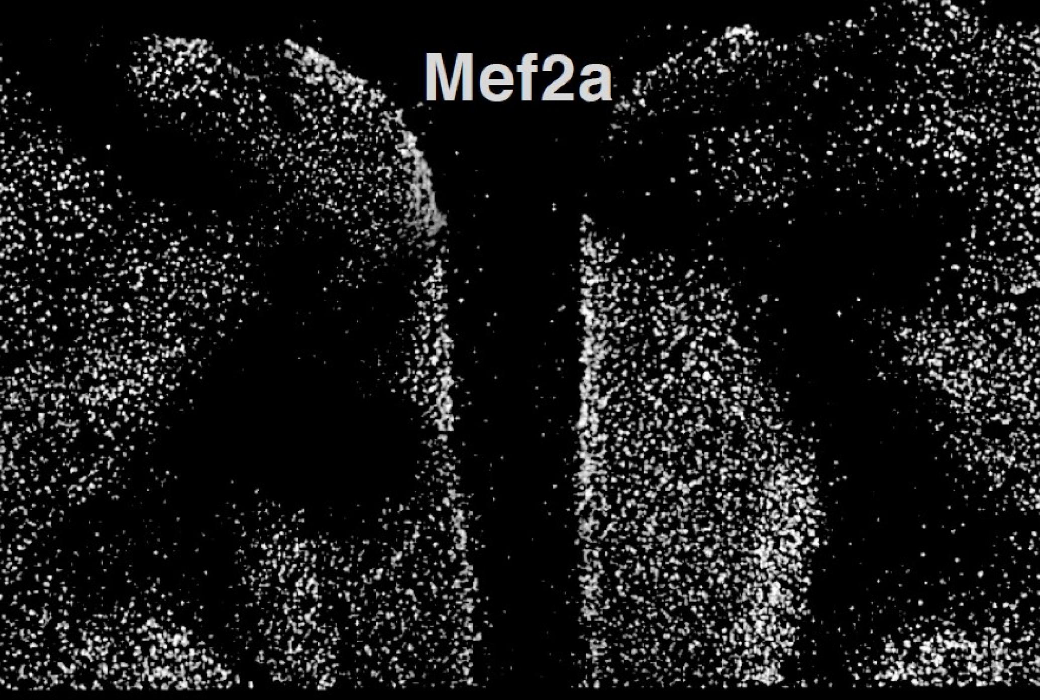 Study links gene to cognitive resilience in the elderly | Picower Institute