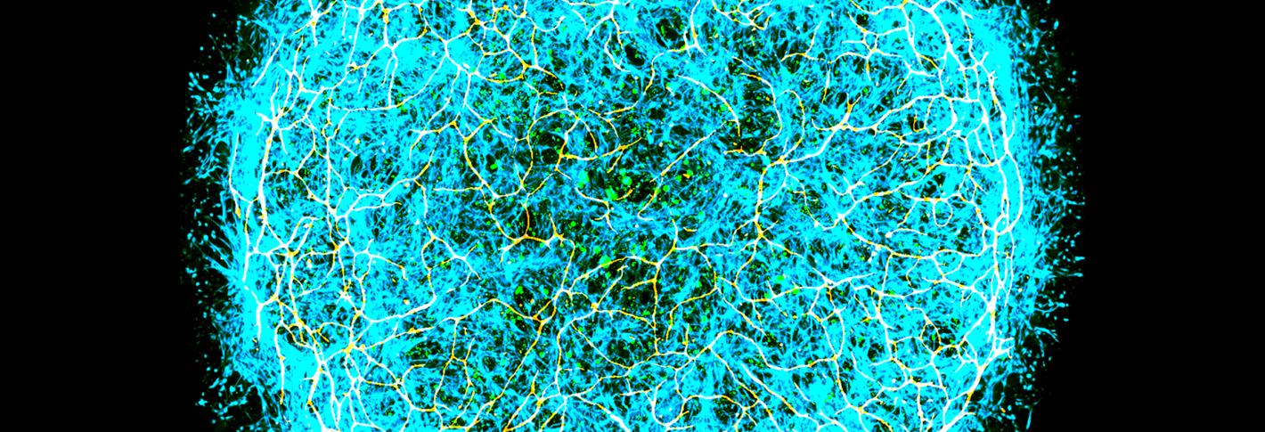 A miBrain stained in different colors looks like a tight tangle of many cells in a thick disk