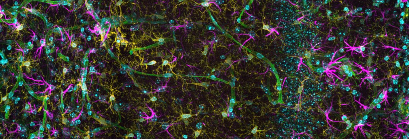 A swath of Alzheimer's model mouse brain with many colorful cells