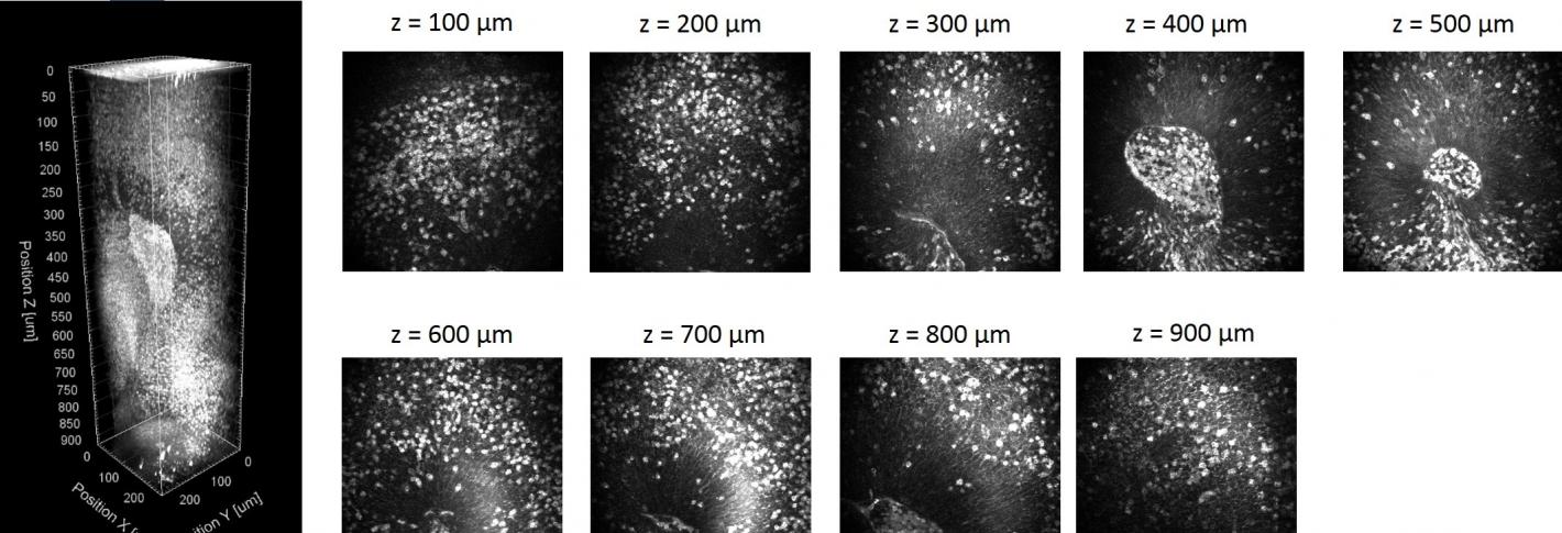 lepton Photon フォトン Advanced Three-Photon Microscopy | Picower Institute