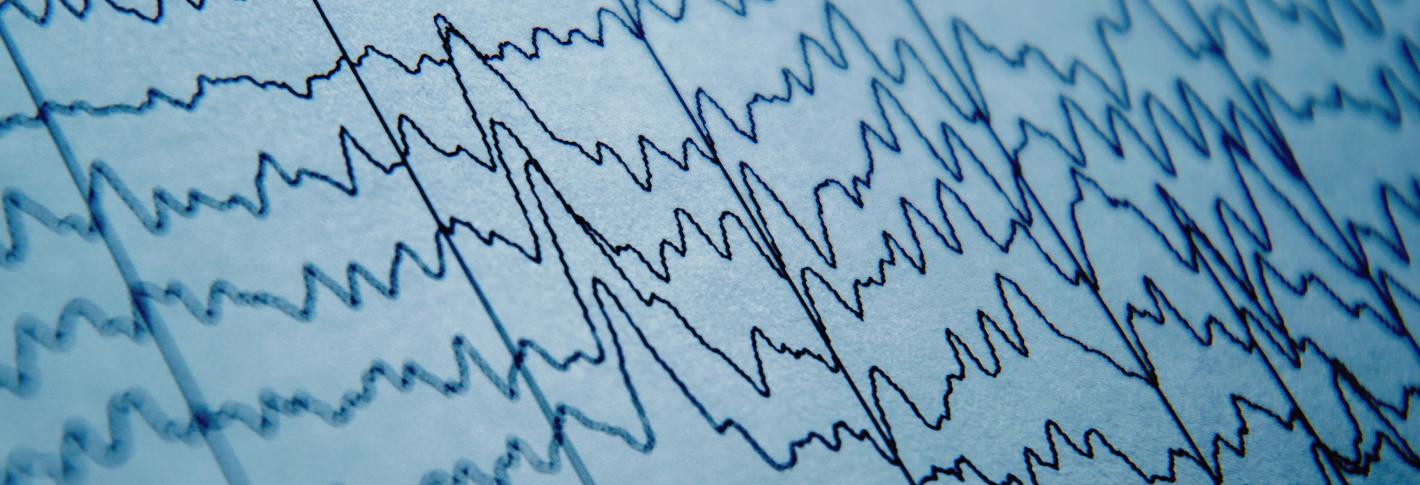 A closeup of a piece of paper displaying many squiggly lines of brainwaves