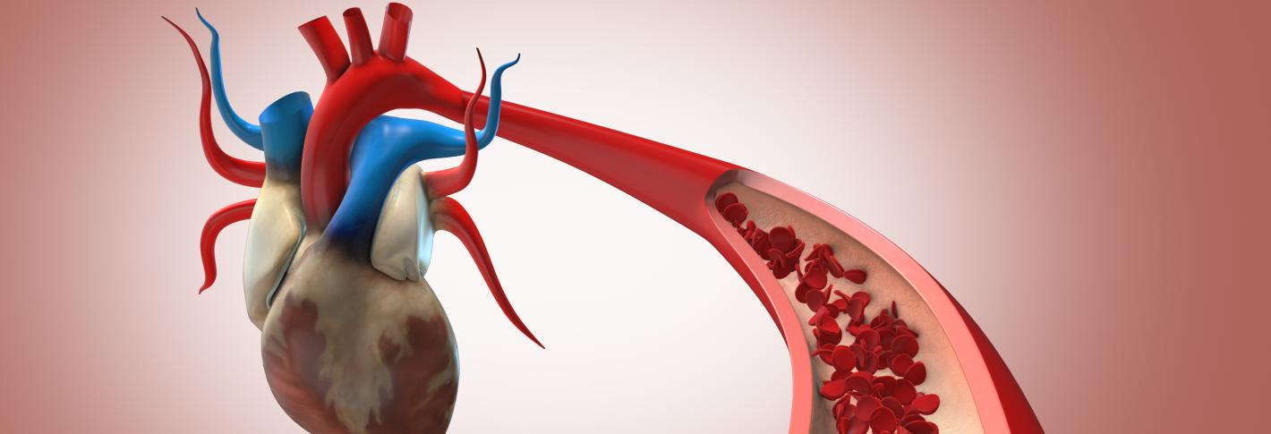 Cartoon image of a heart in the background with a major artery extending into the foreground. The artery is cut away at one point to show a flow of red blood cells within.