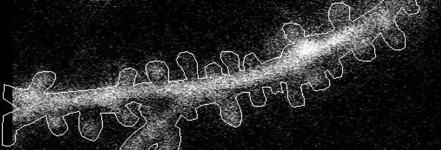 On a black background a spiny section of a neural dendrite is outlined in white. Within the outline numerous little white dots indicate the actual dendrite within the outline.