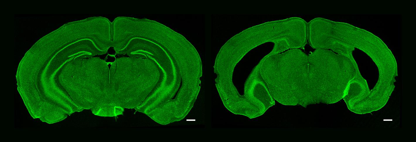 Over a black background are two oval-shaped green-stained mouse brain cross-sections. The right-hand one has big cresecnt-shaped holes on either side.