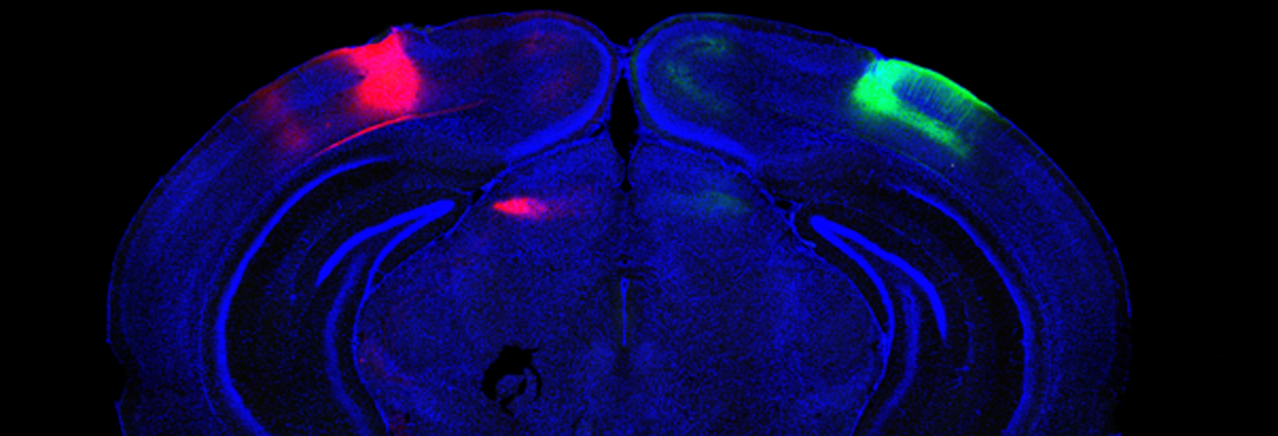 A coronal (ear to ear) cross-section of a mouse brain on a black backround shows the entire brain in blue except a red area on the top left and a green area on the top right